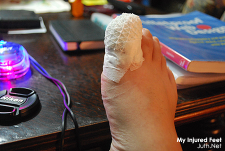 Injured Feet